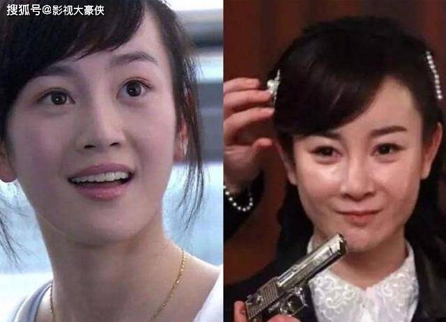 脸部被美容院毁掉的明星，娄艺潇秒变僵尸脸，张檬因整容葬送大好前途