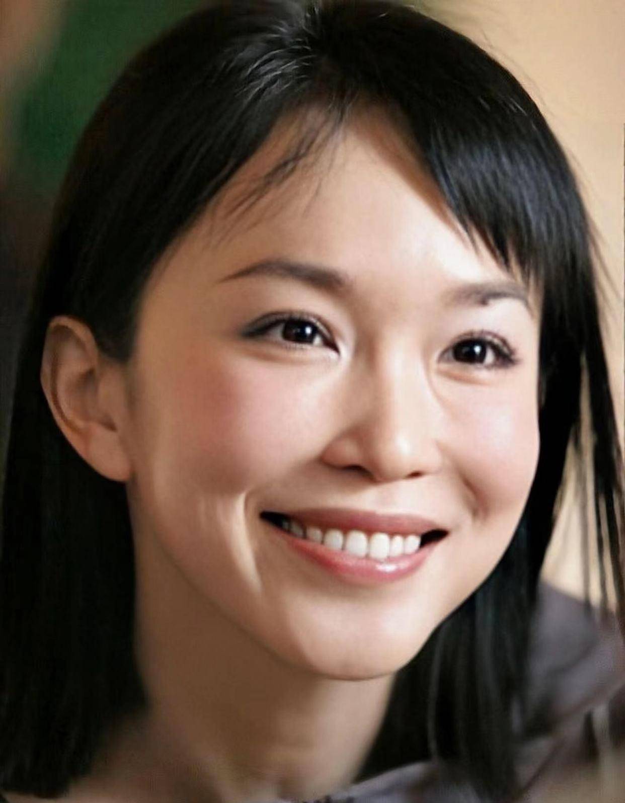 后遗症女明星为了变美，乱整鼻子留下的后遗症，至今悔恨终身
