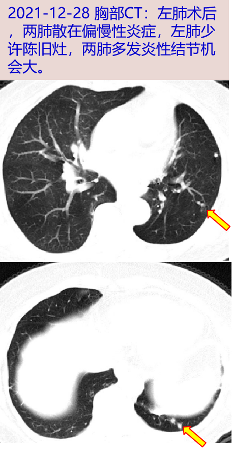症状|身体当中任何出现不良症状都要小心对待,即使就医
