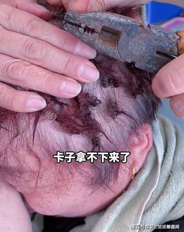 小号大妈发量太少，用超小号发卡烫头，结果发卡拿不下来只得上钳子