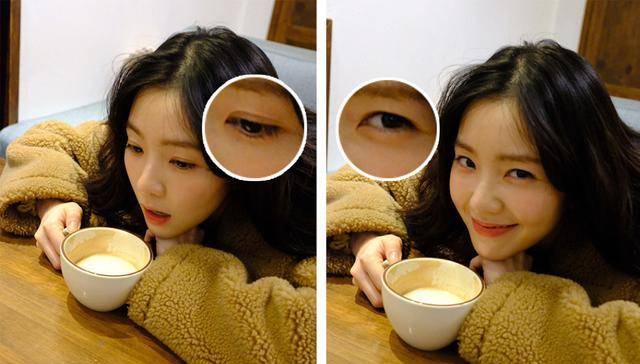 眼睛别再割双眼皮了!内双、肿眼泡的来啦!