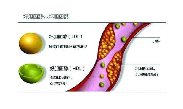 1药网科普：这种胆固醇偏高是导致心梗的元凶，该如何控制？