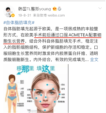 存活率【答疑】脂肪胶需要二次填充嘛？脂肪胶填充脸部可以维持多久？