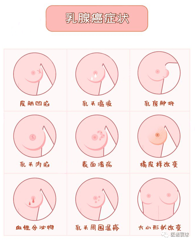 乳房包块种类图片