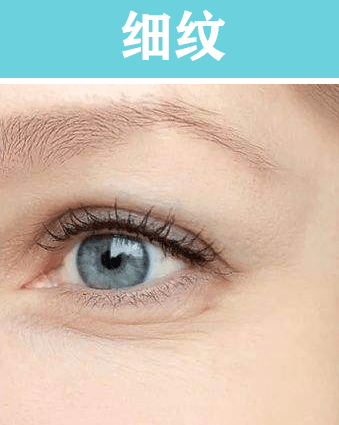 产品干纹细纹和皱纹的区别？怎么去除干纹细纹皱纹的小妙招（配图）