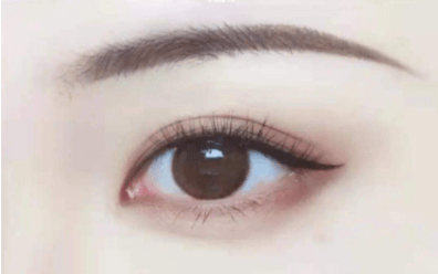 才拉牙突不要紧，“眼凸”才拉垮，死鱼眼显凶又老态，孙俪都深受其害
