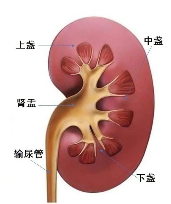 肾结石排石图解图片