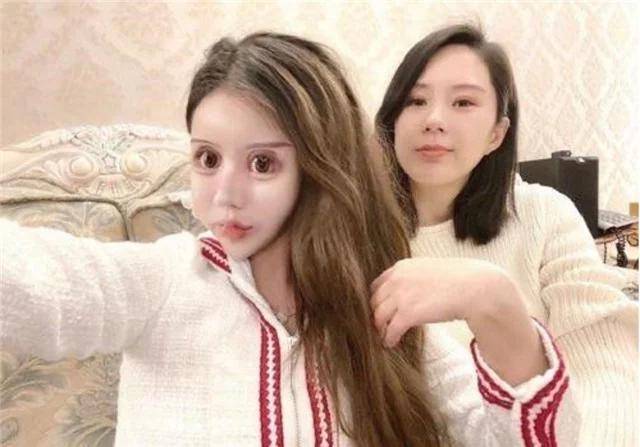 进行当年花百万，利用3年时间将自己整容60次的网红女孩，如今怎样