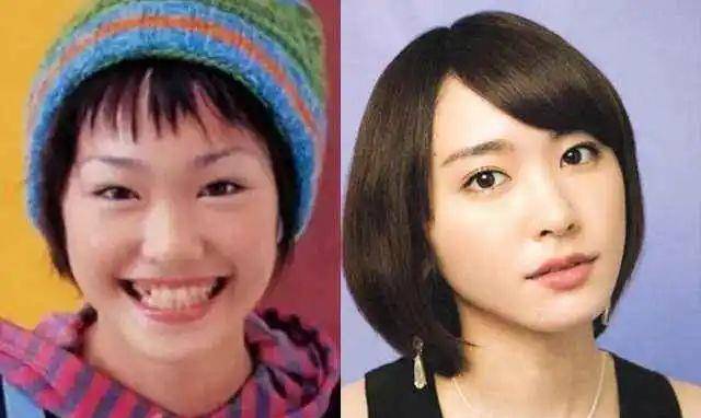 小天关晓彤是不是do脸了？凹脸变得幼态又平整