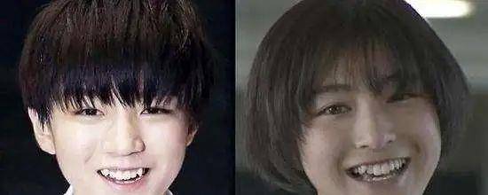小天关晓彤是不是do脸了？凹脸变得幼态又平整