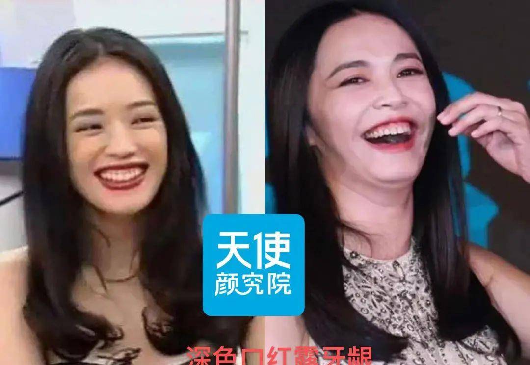 小天关晓彤是不是do脸了？凹脸变得幼态又平整