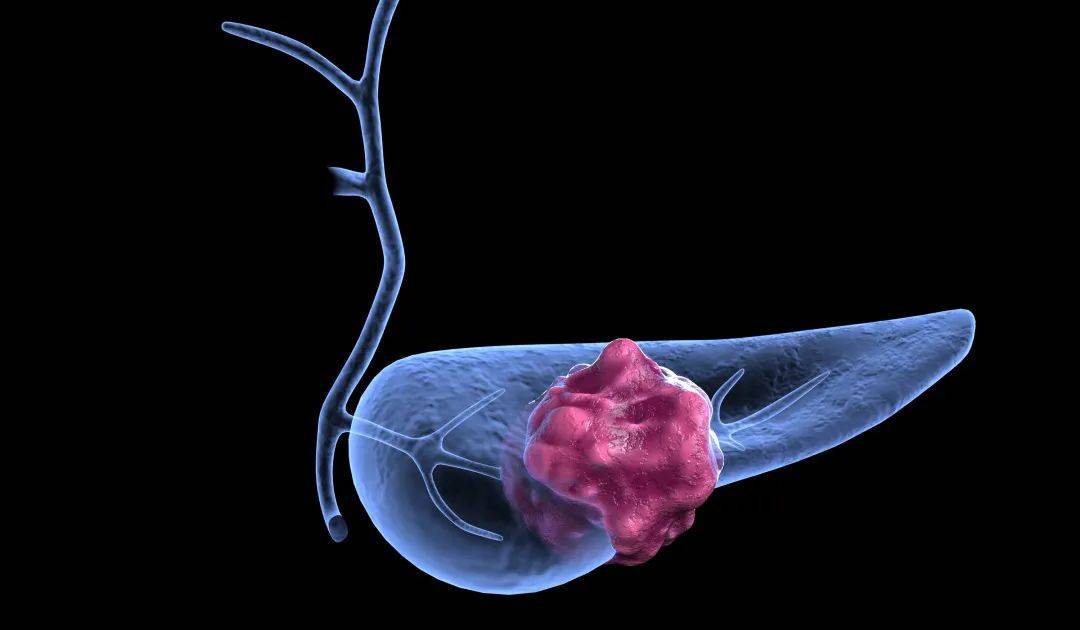 必须到专业的医院进行诊断和治疗,切勿因"懒癌"而贻误病情