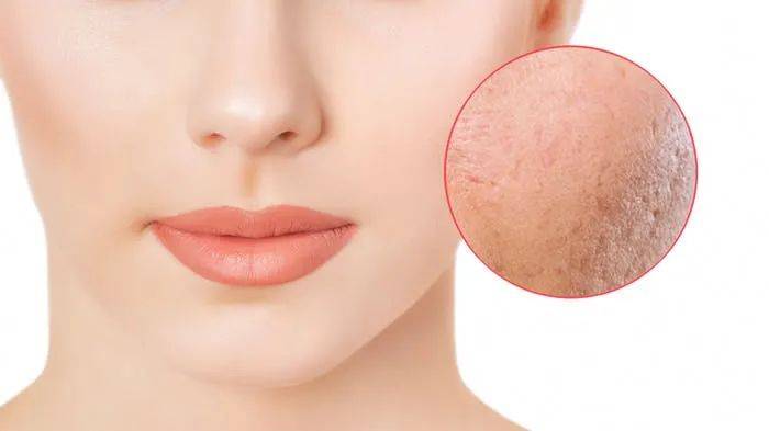 Beauty全球风向 | 敏感肌底妆品牌Supple Supple面市/奇华顿Neoporyl对抗毛孔粗大