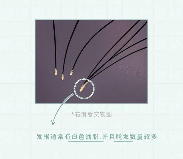 什么头皮出现“白色颗粒”，忍不住用手去挠？但你想过后果吗？