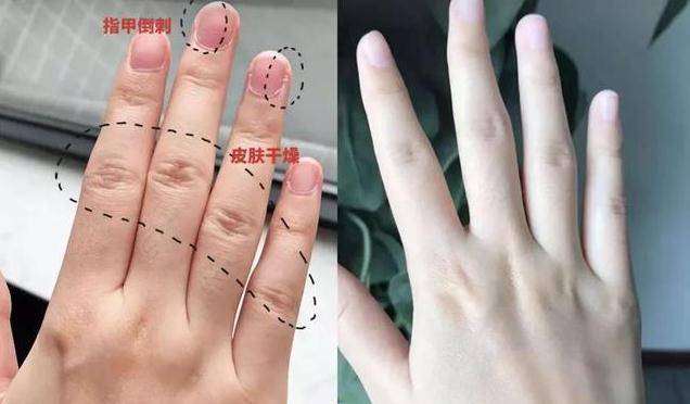 女神不愧是“冻龄女神”，44岁的林志玲，纤纤玉手宛如20岁少女