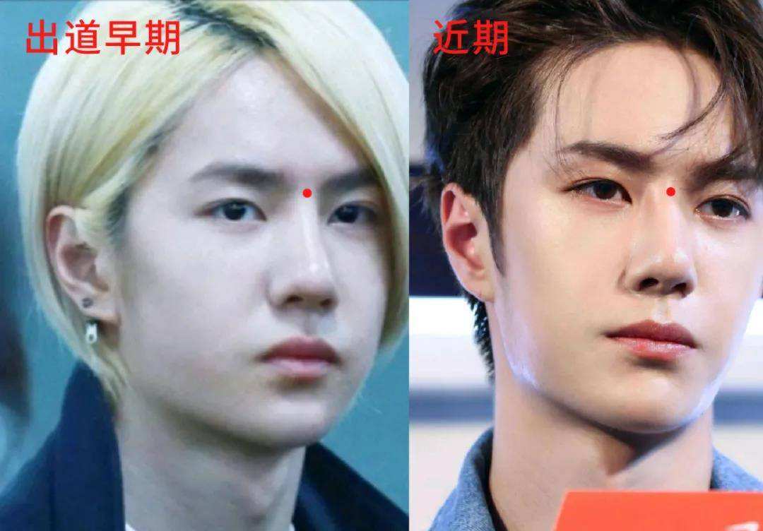 陈晓东脸部肿胀、五官扭曲，这些痴迷医美的男明星，不怕后遗症吗？？