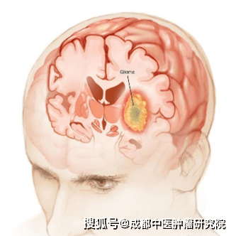 a4dc71fd7c314a4f89152e997766fb6d.png