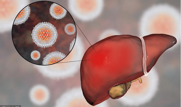 肝脏|肝癌多是拖出来的？提醒：身体出现3异常，或是肝脏正在“求救”
