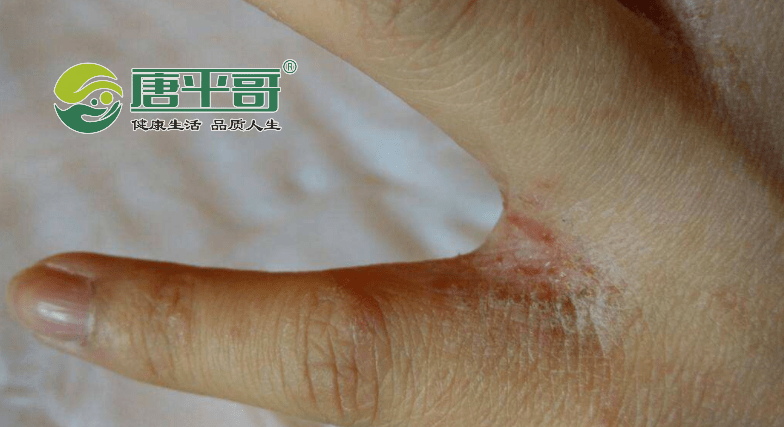 血管|糖尿病这几个危害影响全身,千万不能忽视