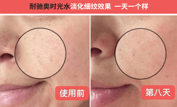 护肤品有皱纹了还能恢复吗，怎么去除细纹最有效，去细纹的小窍门（精）