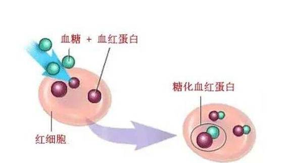 水平|什么是糖化血红蛋白，血糖与糖化血红蛋白有什么区别，哪个更重要