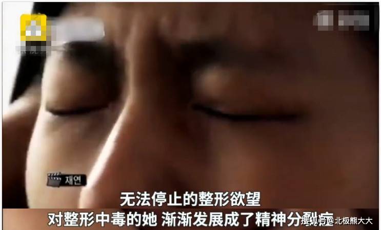因为痴迷整容15年，把脸整成“电风扇”后遗症明显，韩慧景后悔了吗？