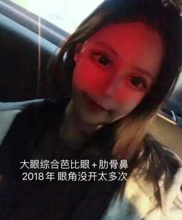 漂亮那个13岁就整容的网红女孩，3年整了60次，如今现状如何？