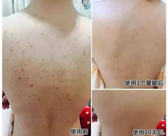 黑头同为姐妹43岁大S颜值回春，只要做到这一点，你也可以实现“冻龄“