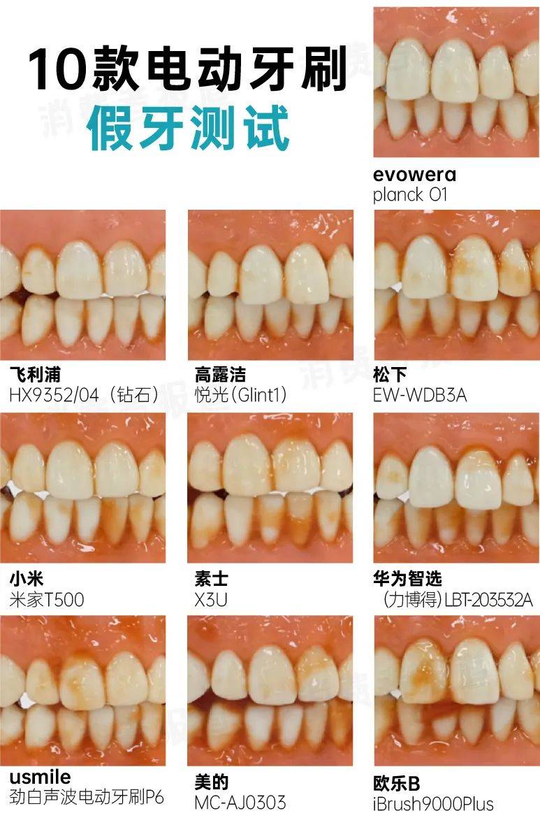 牙刷|10款电动牙刷对比报告：1000元与100元差距在哪儿？消费者该怎么选？