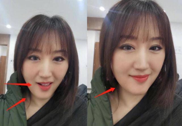 原创50岁杨钰莹现身县城商演与观众互动无人理因美颜过度被指嘴歪