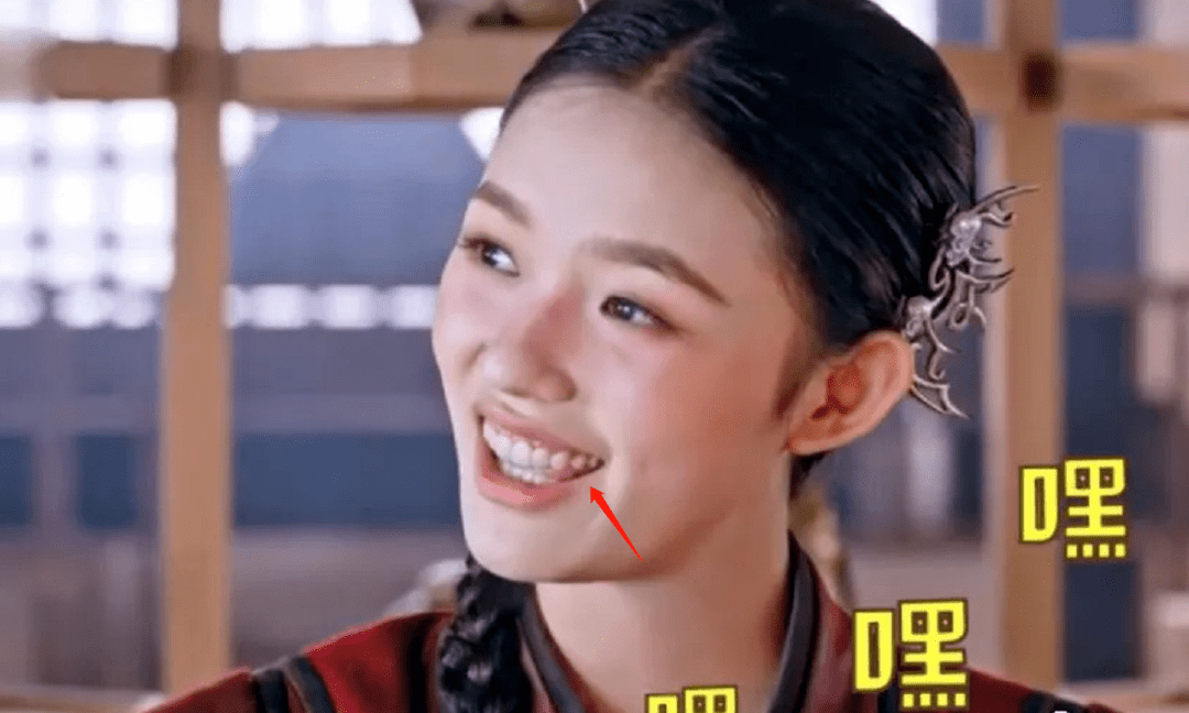 脸部明星整牙后遗症：杨幂脸部松弛，王嘉尔颧骨外扩，宋祖儿法令纹深！！