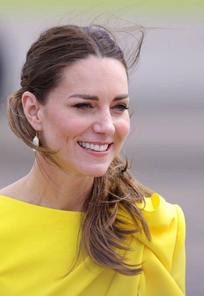 缺点 凯特王妃都有眼角纹了！穿“亮黄”色连衣裙依然无压力，美得迷人