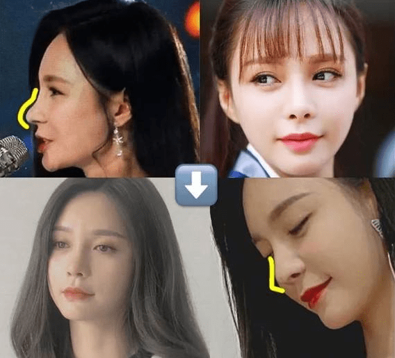下巴整前似大妈、整完变少女？这些“回炉重造”的女明星，太成功了！