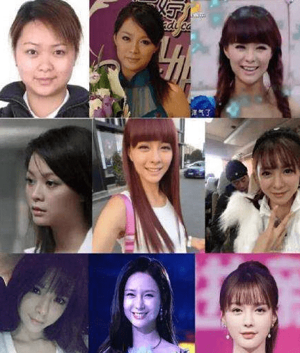 下巴整前似大妈、整完变少女？这些“回炉重造”的女明星，太成功了！