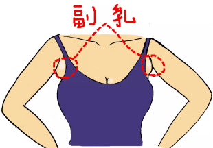 狐大医｜文胸能预防下垂、消除副乳、改善胸型？华西专家来辟谣