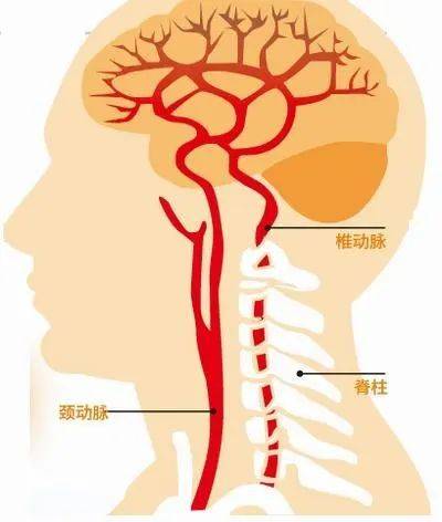 失眠可能是颈椎病惹的祸!