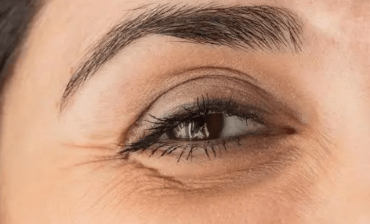 原创眼周应该如何抗衰老这份最全的眼部保养攻略建议照着做