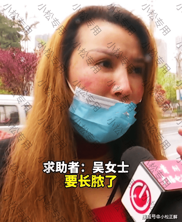 心理准备女子祛斑反被毁容，美容师霸气回复：要想变漂亮，不付出怎么可能