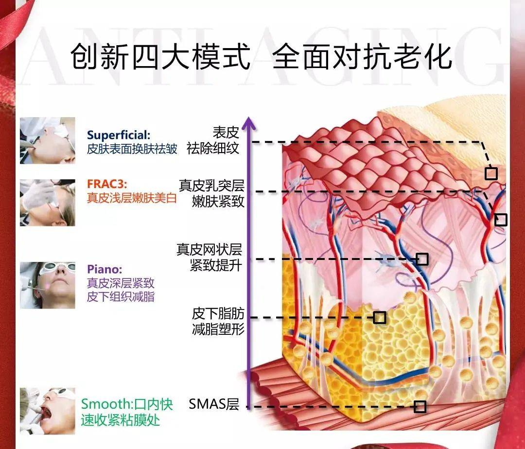 治疗欧洲之星FOTONA到底是什么？