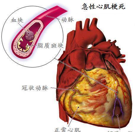 因为|哪5种早餐不建议吃，鸡蛋没有上榜，不知有你爱吃的吗