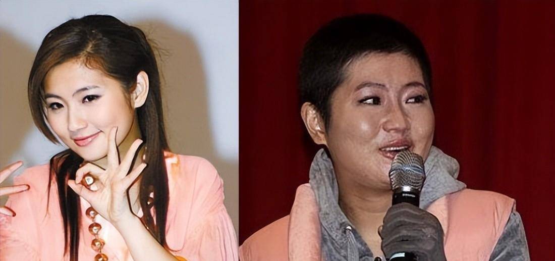 原创她29岁毁容被骂忘恩负义还遭前夫骗婚上位