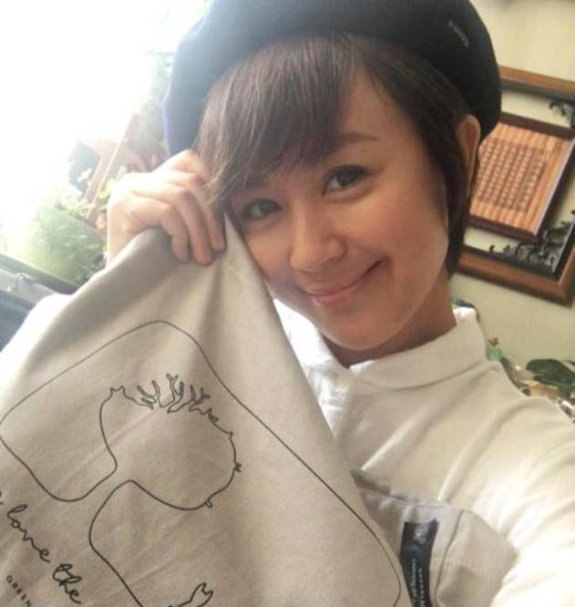 缺陷方脸、皮肤黑、有兔牙…缺陷多又如何？TVB女星一笑遮百丑！