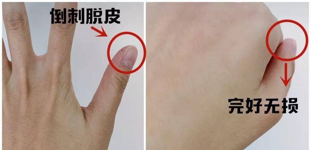 手部38岁谢娜参加活动，却被双手抢镜，网友：难怪张杰这么爱她