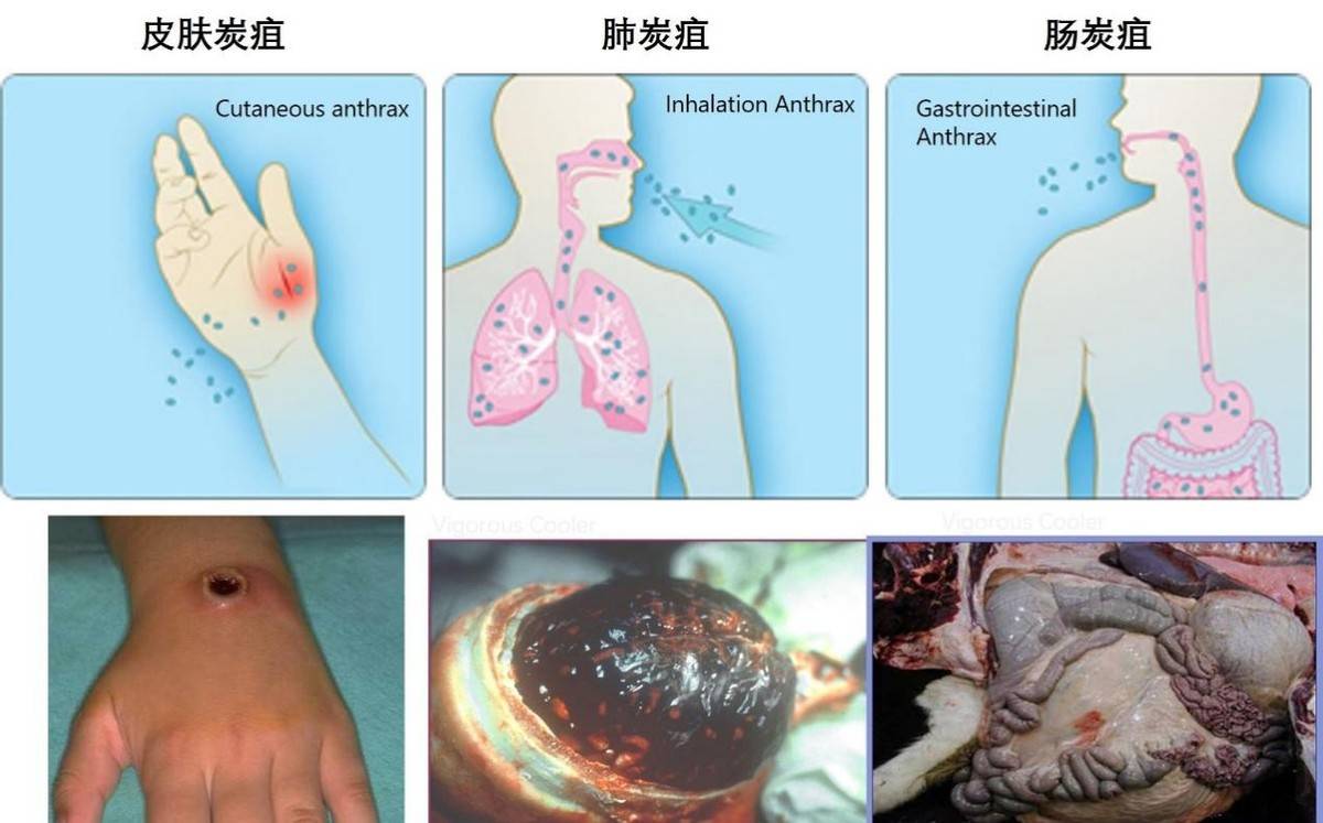 pg电子平台美国生物实验乱象祸害全球！曾将活性炭疽样本寄出究竟有多可怕(图8)