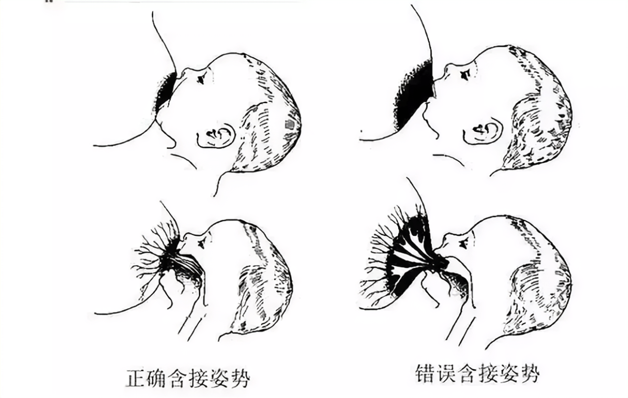 十一媽媽的母乳餵養全攻略,四個乳頭皸裂解決方法_寶寶_姿勢_乳暈