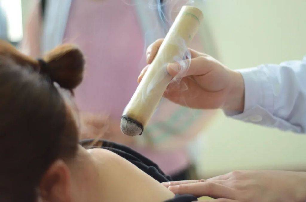 10天进9个社区中医院这群医生把拔罐艾灸耳穴压豆搬到居民家门