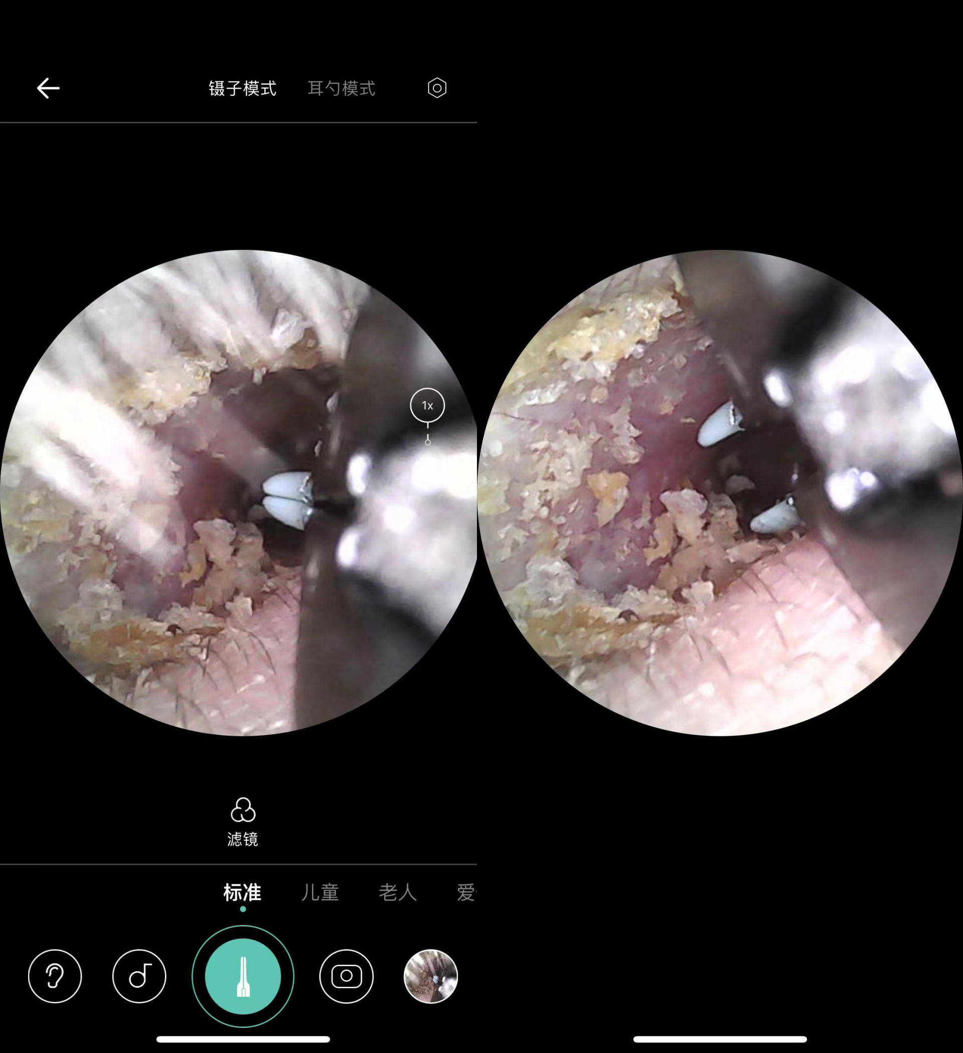 采耳神器note3 pro max体验,真的会上瘾_耳仪_耳道_耳垢