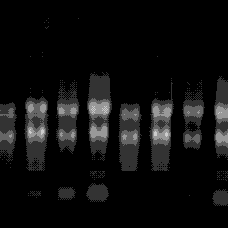 rna降解电泳图图片