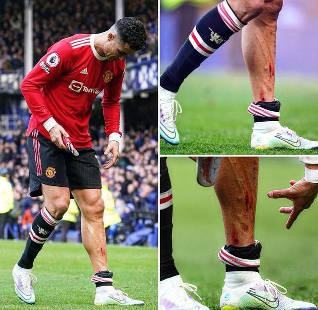 c罗虽然本场比赛哑火,但他的职业精神没有任何问题,依然是场上最拼的