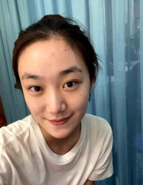 原创孙俪妹妹晒素颜近照真实颜值暴露无遗青春痘和发际线非常抢镜